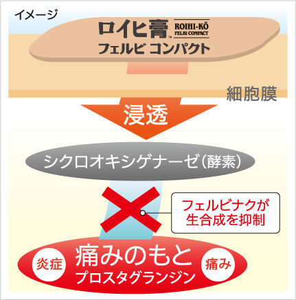 ロイヒ膏 フェルビ コンパクト ニチバン ロイヒ膏 フェルビ コンパクト ニチバン