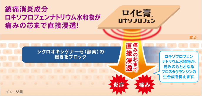 鎮痛消炎成分ロキソプロフェンナトリウム水和物が痛みの芯まで直接浸透！ロキソプロフェンナトリウム水和物が、痛みのもととなるプロスタグランジンの生合成を抑えます。痛みの芯まで直接浸透痛みの芯まで直接浸透/シクロオキシゲナーゼ（酵素）の働きをブロック